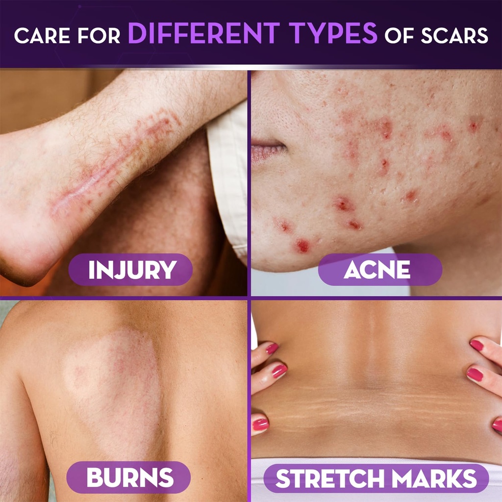 cicatricure-advanced-scar-gel-for-face-b-4.jpg