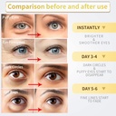 24k-gold-under-eye-patches---60-pack-for-3.jpg