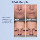 plexaderm-rapid-reduction-eye-serum---vi-4.jpg
