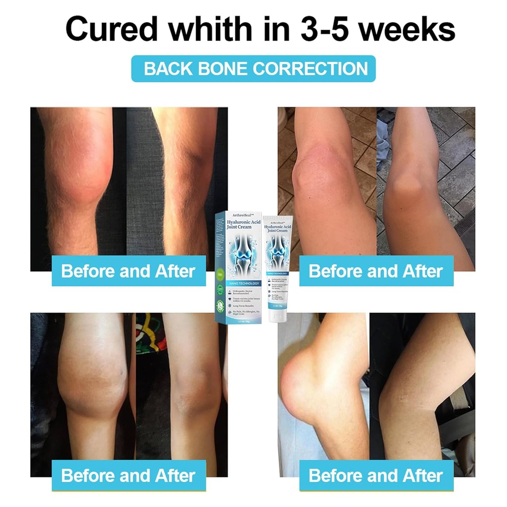 arthroheal-hyaluronic-acid-joint-r-epair-4.jpg