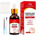 Toe Nail Fungus Toenail的治疗方法:指甲的Nail Fungus治疗方法 – 外力,裂缝的快速动作解决方案,损坏,涂色的钉