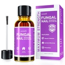 Toenail Fungus 更新工具用于 Toenail & Fingenail: 高级和有效公式