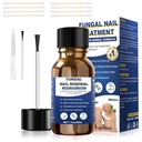 Toenail Fungus治疗,Foot Fungus治疗外力,Fungus Nail治疗,Toe Nail Fungus治疗真菌 黄趾甲治疗(1fl oz/30ml)