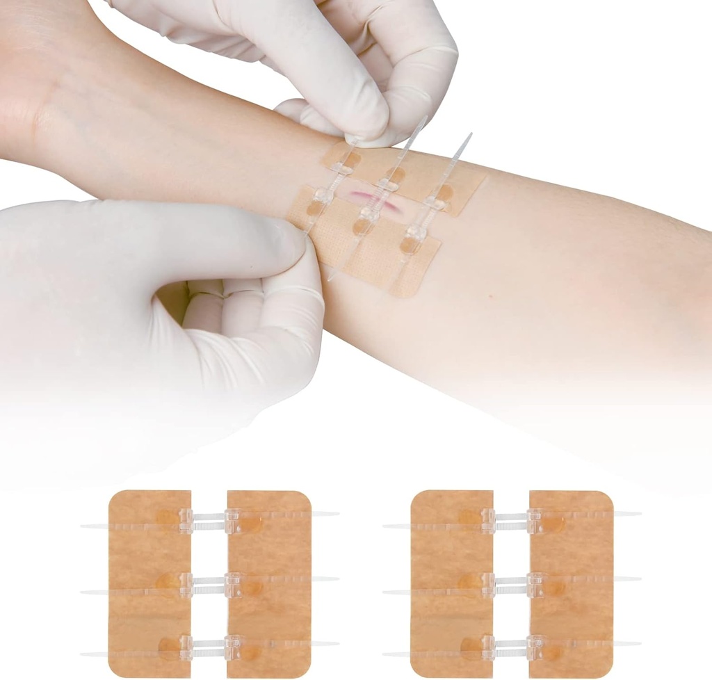 Zip Stitch Laceration Reference Without Stitches Butterfly Bandaids 快衣 - 紧急伤口关闭设备 2 Pips(PU)