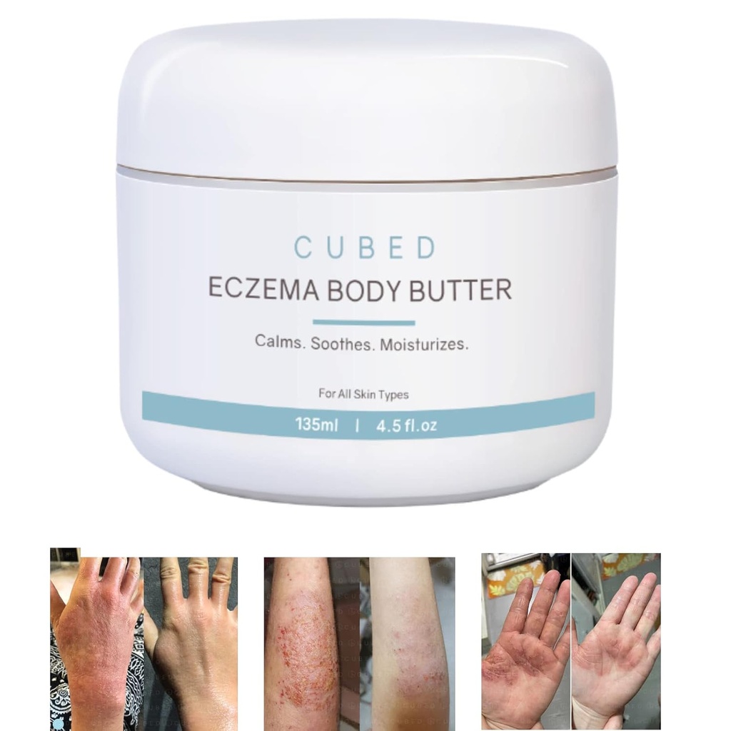 成人用Cubed 4.5 oz Eczema Cream, Eczema Relief, Eczema 治疗, 湿润干燥灌溉皮肤, 立体固醇提取症状的智能 Lotion, Psoriasis & Rosacea, Eczema, 皮肤炎