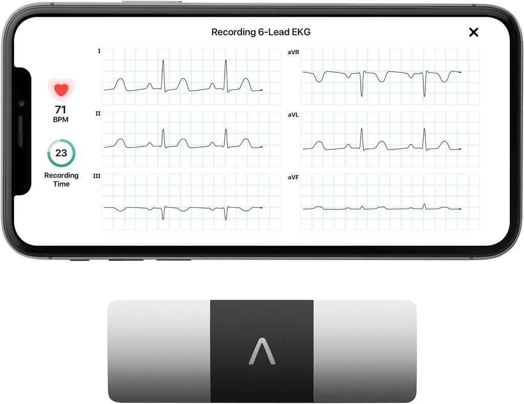 AliveCor KardiaMobile 6-Lead Personal EKG 监视器 – 心脏的六处观点 – 检测AFib和不规则的心律 – 30秒即时结果 – 与大多数智能手机一起工作