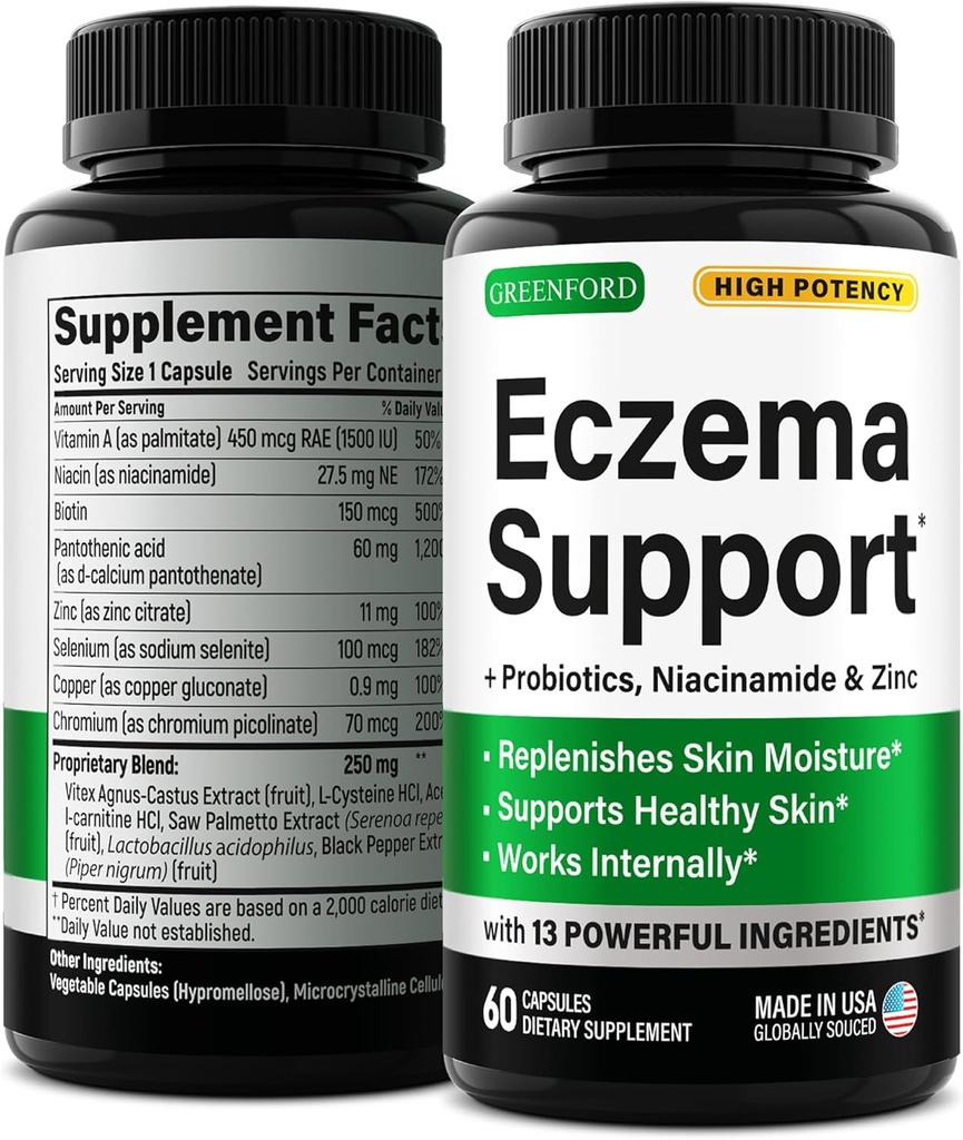 Greenford Eczema治疗和支持自然救济 -- -- 在美国制造 -- -- Eczema、Acne、Psoriasis、Rosacea治疗锌、Niacinamide和Probiotics的皮肤维生素和草药 -- -- 60帽