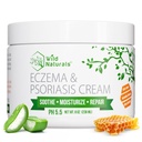野生自然 Eczema & Psoriasis Cream for Dry, Itchy Skin – Eczema Relief for 成人和孩子 – 用玛努卡蜂蜜摩擦Psorias Cream – 将蜂蜜洗洗洗手和脸