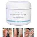 成人用Cubed 4.5 oz Eczema Cream, Eczema Relief, Eczema 治疗, 湿润干燥灌溉皮肤, 立体固醇提取症状的智能 Lotion, Psoriasis & Rosacea, Eczema, 皮肤炎