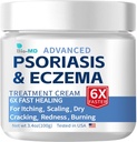 生物-MD Psoriasis Eczema Cream, Eczema Cream for Adults, 超强控制复发, Relieve Synmptom of resistant, 有效治疗 Seborrheic 皮肤炎, Folliculitis 治疗
