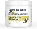 高强度蜜蜂 Venom Cream, Dyshidrodrotic Eczema Ointment,热拉什,Iching, Eczema, Psoriasis, Leg, 胃,脚,手,刺激皮肤,全年龄护理