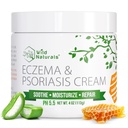 野生自然 Eczema & Psoriasis Cream for Dry, Itchy Skin – Eczema Relief for 成人与儿童 – 用玛努卡蜂蜜摩托Psorias Cream 配音